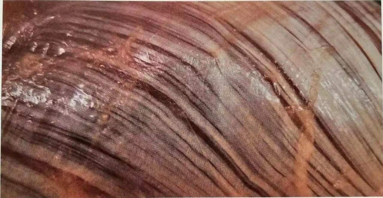 拉伸、瑜伽常说的筋膜是什么? 一文全搞懂!  筋膜 肌肉 骨骼 生理解剖学 西安瑜伽培训 瑜伽体位法 瑜伽正位 学瑜伽 封闭式瑜伽培训 包食宿 就业 第 2 张