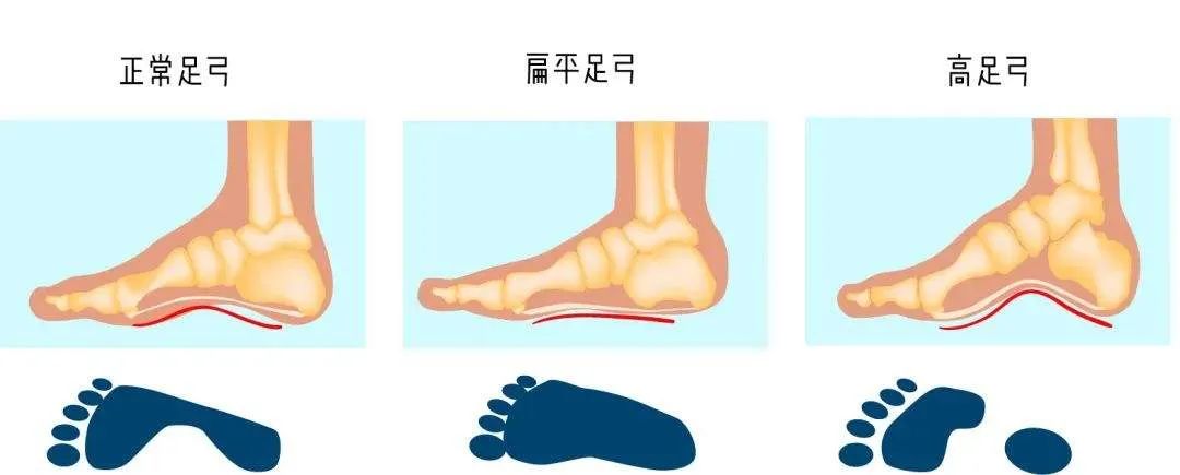 堪称“天然减震器”的足弓，在瑜伽练习中如何激活它？  甲状腺 心轮 战士 2 姿势排序的 5 种方法 王瑜伽 瑜伽呼吸技巧 第 3 张