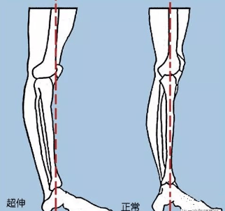 练瑜伽为什么要强调“正位”？这 6 大原则一定要知道！  第 9 张