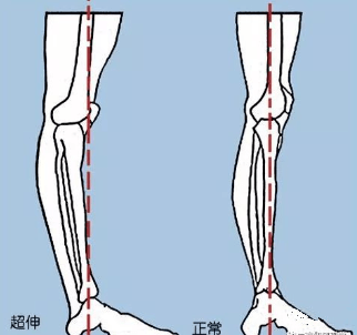 练瑜伽为什么要强调“正位”？这 6 大原则一定要知道！