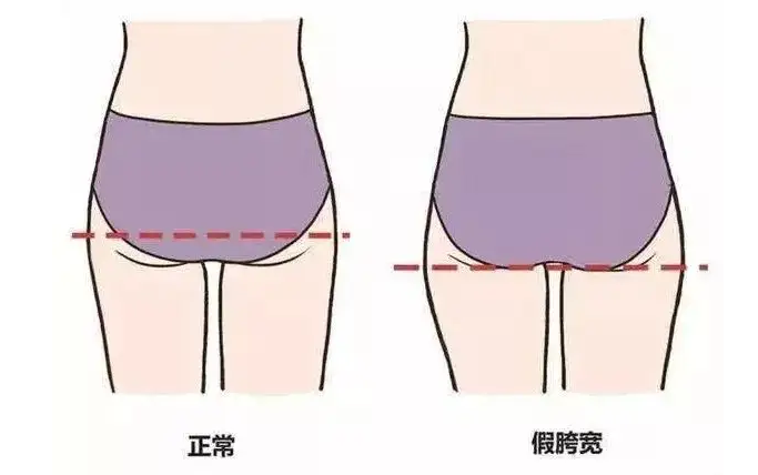 10 分钟“缩胯操”，消灭「假胯宽」，腿长了，腰瘦了！  第 8 张
