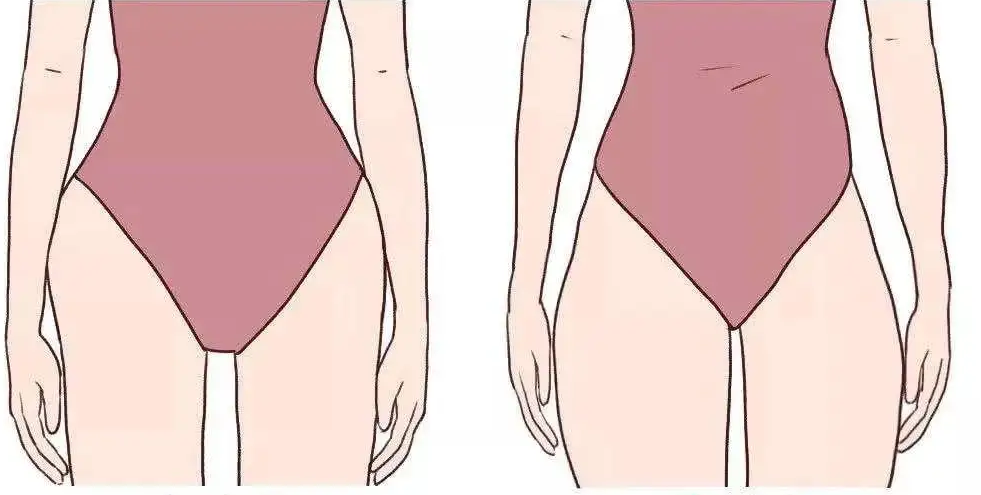 10 分钟“缩胯操”，消灭「假胯宽」，腿长了，腰瘦了！  第 4 张