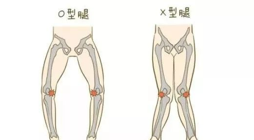 腿粗腰肥，干练没效果？可能是“骨盆”出问题了！动图教程  第 2 张