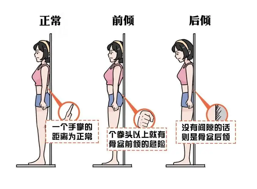 私教老师才会教！腰腹赘肉减不掉，可能是骨盆前倾！（附瑜伽调理）  第 2 张