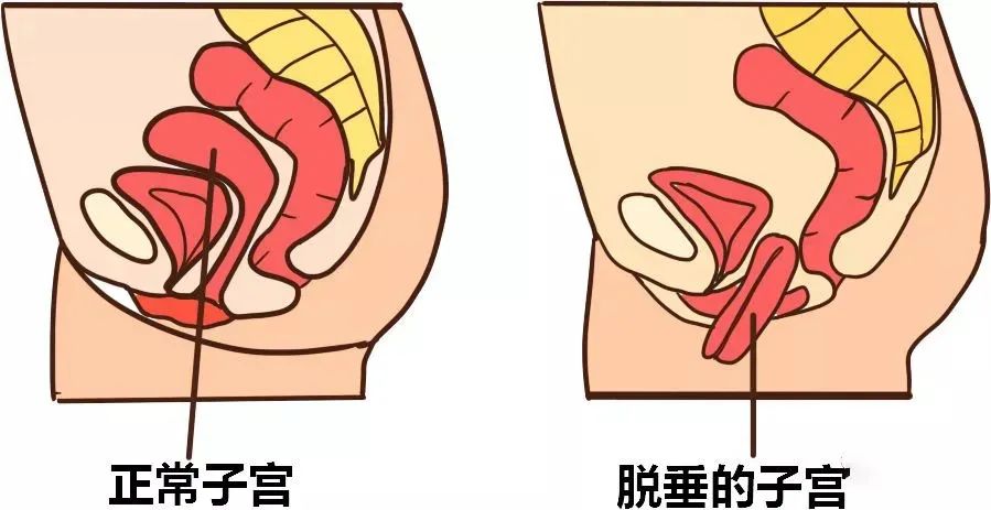 这个“部位”关乎女性一生幸福，保养不好危害太多！越早瑜伽越好！  第 2 张