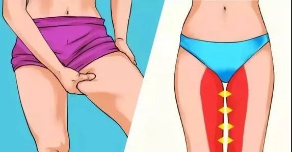 每天 5 分钟女神式,瘦大腿内侧效果惊人! 第 1 张 每天 5 分钟女神式,瘦大腿内侧效果惊人! 第 1 张