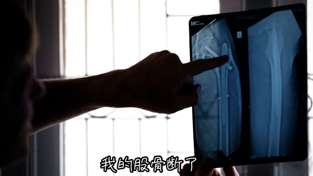 他练阿斯汤加 10 多年,经历车祸差点瘫痪,1 年后重新开始,让无数人感动! 第 2 张 他练阿斯汤加 10 多年,经历车祸差点瘫痪,1 年后重新开始,让无数人感动! 第 2 张