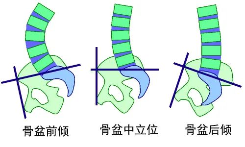 练瑜伽,“提耻骨”和“卷尾骨”到底有什么区别? 第 3 张 练瑜伽,“提耻骨”和“卷尾骨”到底有什么区别? 第 3 张