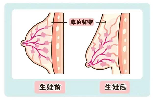 产后瑜伽理疗乳房的修复过程中的时间及注意点, 关键点  产后瑜伽 产后乳房 产后修复 第 1 张