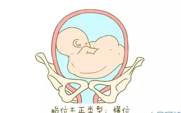 「孕妈收藏」成功调整了 2000 个胎位不正的宝妈后,我把方法汇总在了这篇文章内 第 6 张 「孕妈收藏」成功调整了 2000 个胎位不正的宝妈后,我把方法汇总在了这篇文章内 第 6 张