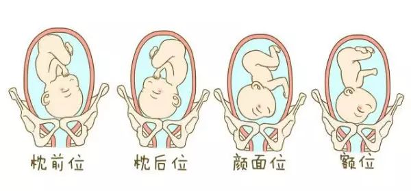 「孕妈收藏」成功调整了 2000 个胎位不正的宝妈后,我把方法汇总在了这篇文章内 第 4 张 「孕妈收藏」成功调整了 2000 个胎位不正的宝妈后,我把方法汇总在了这篇文章内 第 4 张