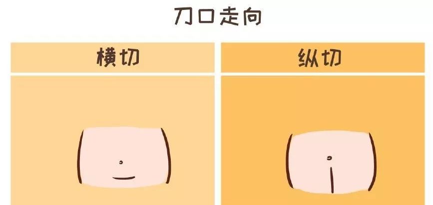 漏尿, 盆腔器官脱垂, 阴道松弛... 这些“麻烦精”主要是盆底受损或功能下降造成 第 6 张 漏尿, 盆腔器官脱垂, 阴道松弛... 这些“麻烦精”主要是盆底受损或功能下降造成 第 6 张