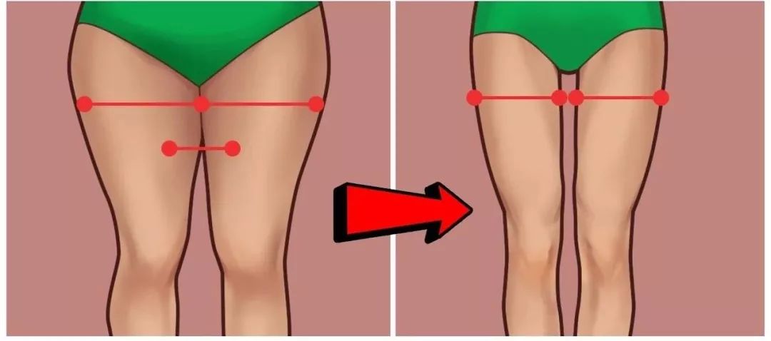 大腿粗怎么瘦?你可能中招了这 6 点!附大腿内、外、前、后赘肉练习 第 4 张 大腿粗怎么瘦?你可能中招了这 6 点!附大腿内、外、前、后赘肉练习 第 4 张