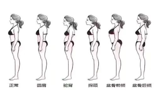 90% 的人骨盆移位 , 需要瑜伽来矫正! 骨盆 肌肉 骨盆移位 跷二郎腿 办公臀 移位 第 4 张 90% 的人骨盆移位 , 需要瑜伽来矫正! 骨盆 肌肉 骨盆移位 跷二郎腿 办公臀 移位 第 4 张