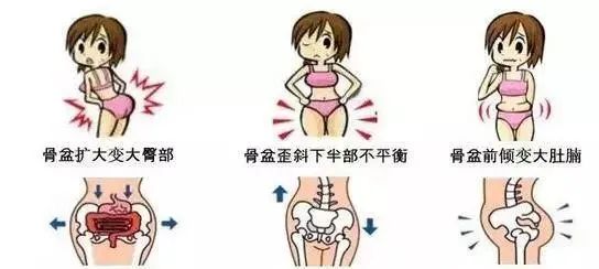90% 的人骨盆移位 , 需要瑜伽来矫正! 骨盆 肌肉 骨盆移位 跷二郎腿 办公臀 移位 第 9 张 90% 的人骨盆移位 , 需要瑜伽来矫正! 骨盆 肌肉 骨盆移位 跷二郎腿 办公臀 移位 第 9 张