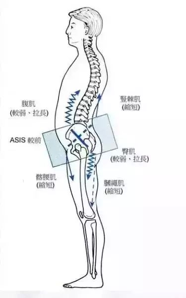 完美的体态,你想拥有吗?一套体态矫正序例! 体形矫正 骨盆 体态 膝盖 背部 肩膀 肌肉 第 15 张 完美的体态,你想拥有吗?一套体态矫正序例! 体形矫正 骨盆 体态 膝盖 背部 肩膀 肌肉 第 15 张