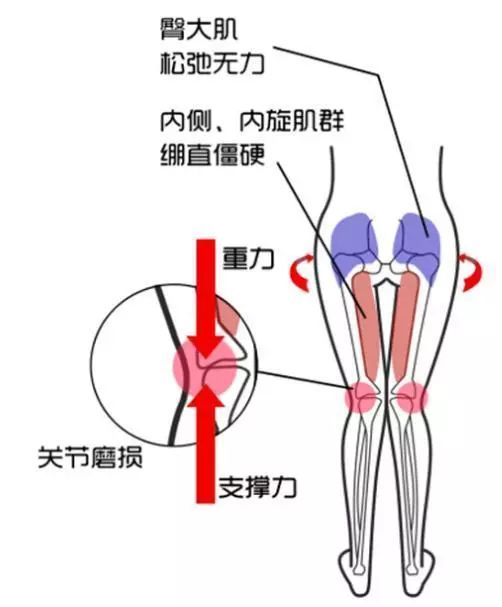 完美的体态,你想拥有吗?一套体态矫正序例! 体形矫正 骨盆 体态 膝盖 背部 肩膀 肌肉 第 29 张 完美的体态,你想拥有吗?一套体态矫正序例! 体形矫正 骨盆 体态 膝盖 背部 肩膀 肌肉 第 29 张