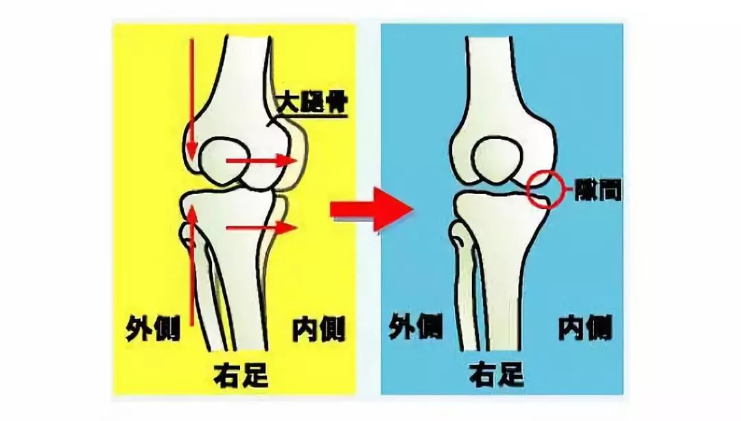 完美的体态,你想拥有吗?一套体态矫正序例! 体形矫正 骨盆 体态 膝盖 背部 肩膀 肌肉 第 24 张 完美的体态,你想拥有吗?一套体态矫正序例! 体形矫正 骨盆 体态 膝盖 背部 肩膀 肌肉 第 24 张