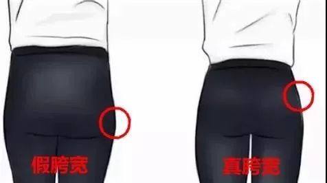 10 分钟缩胯操,消灭假胯宽,让你腿长 15 公分,腰瘦 5 厘米! 大腿 位置 胯宽 髋部 视觉 角度 肌肉 第 5 张 10 分钟缩胯操,消灭假胯宽,让你腿长 15 公分,腰瘦 5 厘米! 大腿 位置 胯宽 髋部 视觉 角度 肌肉 第 5 张