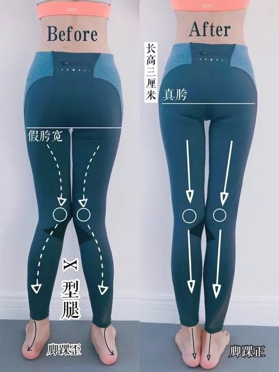 10 分钟缩胯操,消灭假胯宽,让你腿长 15 公分,腰瘦 5 厘米! 大腿 位置 胯宽 髋部 视觉 角度 肌肉 第 10 张 10 分钟缩胯操,消灭假胯宽,让你腿长 15 公分,腰瘦 5 厘米! 大腿 位置 胯宽 髋部 视觉 角度 肌肉 第 10 张