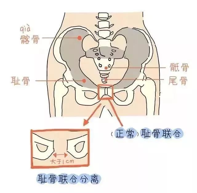 产后骨盆修复、盆底肌康复、腹直肌分离康复——图解 + 详解都在这里 瑜伽 盆底肌 产后修复 盆底肌康复 产后骨盆修复 腹直肌分离康复 第 10 张 产后骨盆修复、盆底肌康复、腹直肌分离康复——图解 + 详解都在这里 瑜伽 盆底肌 产后修复 盆底肌康复 产后骨盆修复 腹直肌分离康复 第 10 张