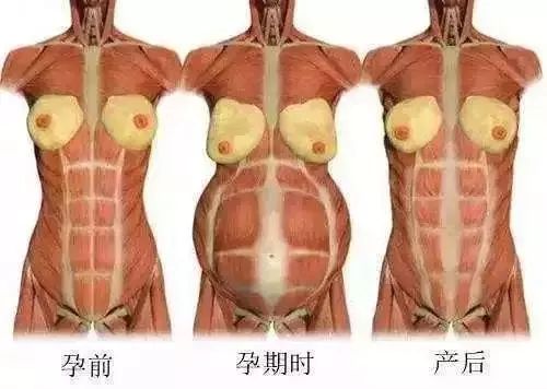 产后骨盆修复、盆底肌康复、腹直肌分离康复——图解 + 详解都在这里 瑜伽 盆底肌 产后修复 盆底肌康复 产后骨盆修复 腹直肌分离康复 第 35 张 产后骨盆修复、盆底肌康复、腹直肌分离康复——图解 + 详解都在这里 瑜伽 盆底肌 产后修复 盆底肌康复 产后骨盆修复 腹直肌分离康复 第 35 张