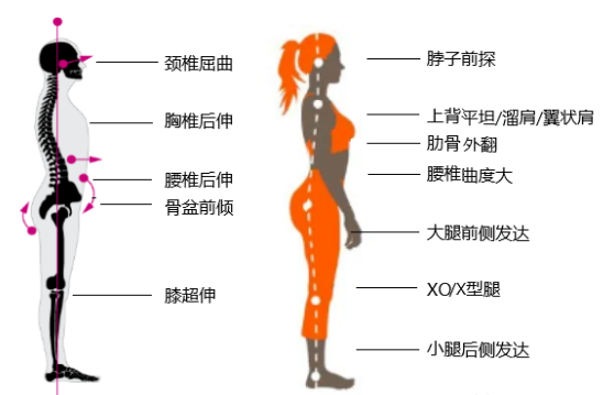 瑜伽培训. 瑜伽私教课的体态和体态自我评估, 健康美丽的头等大事 | 干货 体态 膝盖 问题 姿势 脊柱 身体 曲度 第 7 张 瑜伽培训. 瑜伽私教课的体态和体态自我评估, 健康美丽的头等大事 | 干货 体态 膝盖 问题 姿势 脊柱 身体 曲度 第 7 张
