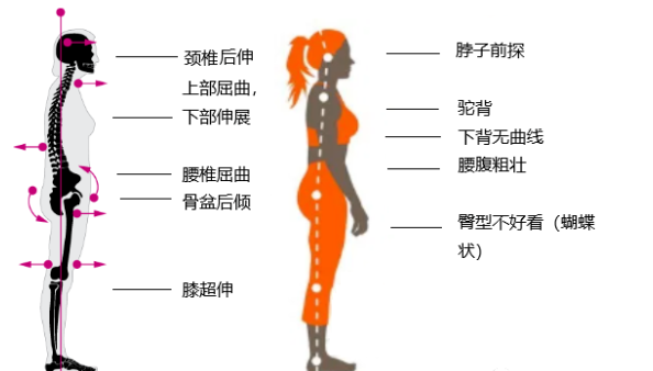 瑜伽培训. 瑜伽私教课的体态和体态自我评估, 健康美丽的头等大事 | 干货 体态 膝盖 问题 姿势 脊柱 身体 曲度 第 9 张 瑜伽培训. 瑜伽私教课的体态和体态自我评估, 健康美丽的头等大事 | 干货 体态 膝盖 问题 姿势 脊柱 身体 曲度 第 9 张