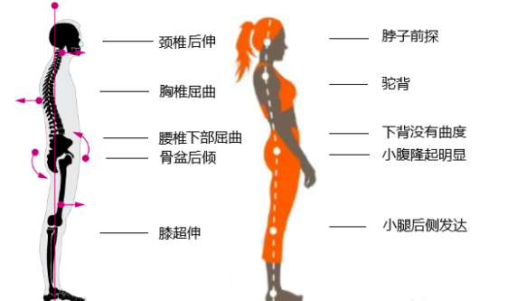 瑜伽培训. 瑜伽私教课的体态和体态自我评估, 健康美丽的头等大事 | 干货 体态 膝盖 问题 姿势 脊柱 身体 曲度 第 10 张 瑜伽培训. 瑜伽私教课的体态和体态自我评估, 健康美丽的头等大事 | 干货 体态 膝盖 问题 姿势 脊柱 身体 曲度 第 10 张