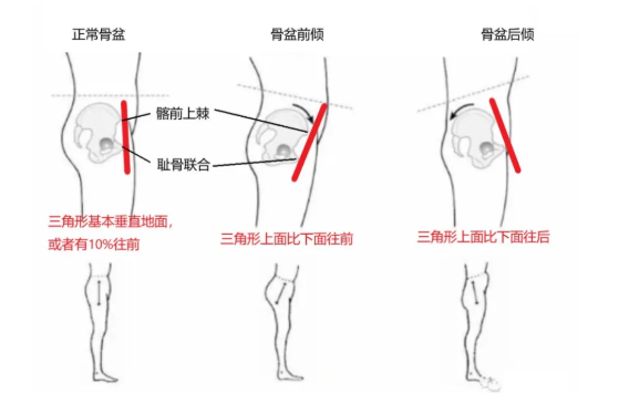 瑜伽培训. 瑜伽私教课的体态和体态自我评估, 健康美丽的头等大事 | 干货 体态 膝盖 问题 姿势 脊柱 身体 曲度 第 33 张 瑜伽培训. 瑜伽私教课的体态和体态自我评估, 健康美丽的头等大事 | 干货 体态 膝盖 问题 姿势 脊柱 身体 曲度 第 33 张