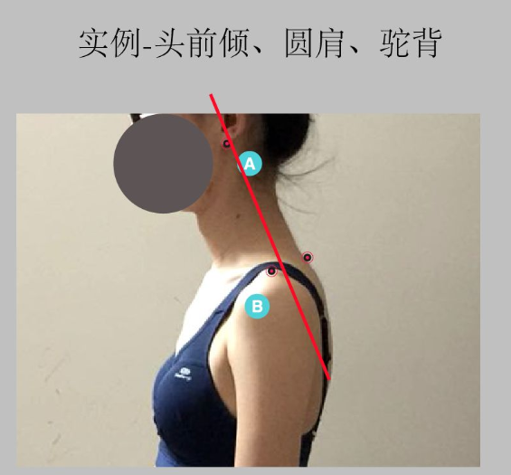 瑜伽培训. 瑜伽私教课的体态和体态自我评估, 健康美丽的头等大事 | 干货 体态 膝盖 问题 姿势 脊柱 身体 曲度 第 36 张 瑜伽培训. 瑜伽私教课的体态和体态自我评估, 健康美丽的头等大事 | 干货 体态 膝盖 问题 姿势 脊柱 身体 曲度 第 36 张