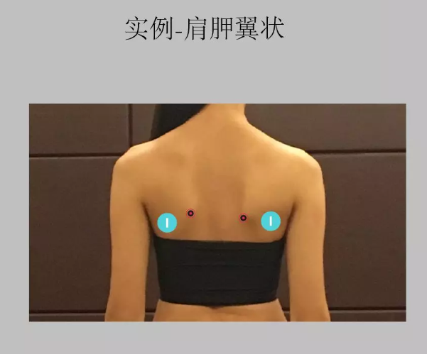 瑜伽培训. 瑜伽私教课的体态和体态自我评估, 健康美丽的头等大事 | 干货 体态 膝盖 问题 姿势 脊柱 身体 曲度 第 50 张 瑜伽培训. 瑜伽私教课的体态和体态自我评估, 健康美丽的头等大事 | 干货 体态 膝盖 问题 姿势 脊柱 身体 曲度 第 50 张