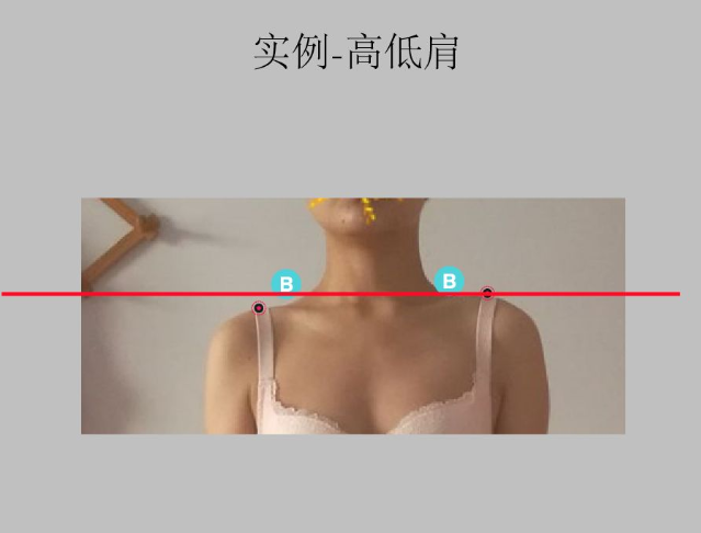 瑜伽培训. 瑜伽私教课的体态和体态自我评估, 健康美丽的头等大事 | 干货 体态 膝盖 问题 姿势 脊柱 身体 曲度 第 52 张 瑜伽培训. 瑜伽私教课的体态和体态自我评估, 健康美丽的头等大事 | 干货 体态 膝盖 问题 姿势 脊柱 身体 曲度 第 52 张